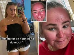 Sự thật về cô gái phơi nắng một giờ, gương mặt lập tức to lên gấp đôi