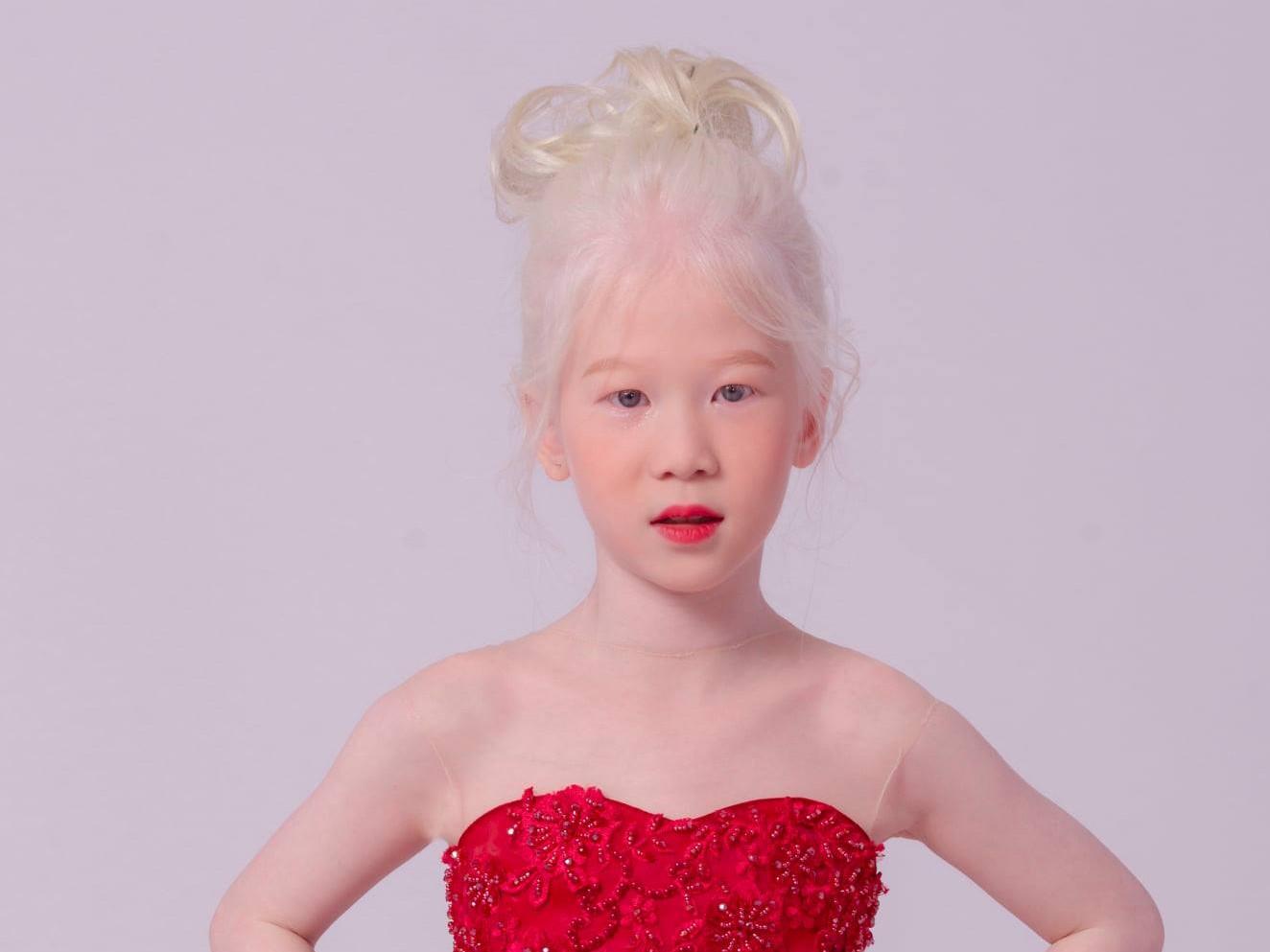 Chân dung người mẫu bạch tạng 8 tuổi trình diễn tại Tuần lễ thời trang Việt Nam 2020