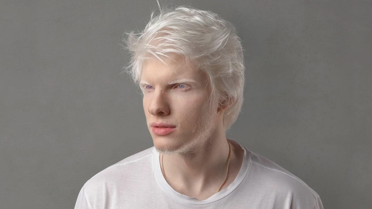 5 người mẫu với vẻ đẹp vượt chuẩn mực, truyền cảm hứng