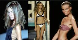 Cơn ác mộng người mẫu "Size 0": Người mẫu nhịn ăn, "Bạch Cốt Tinh" hiện hình trên sàn diễn