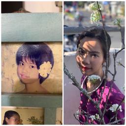 Trải nghiệm chỉnh nha, sửa răng của cô gái từng bị bạn bè gọi là "vịt Donald" vì sở hữu hàm răng hô