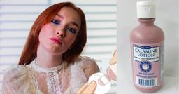 Mối nguy hại khủng khiếp từ kem dưỡng da chứa calamine