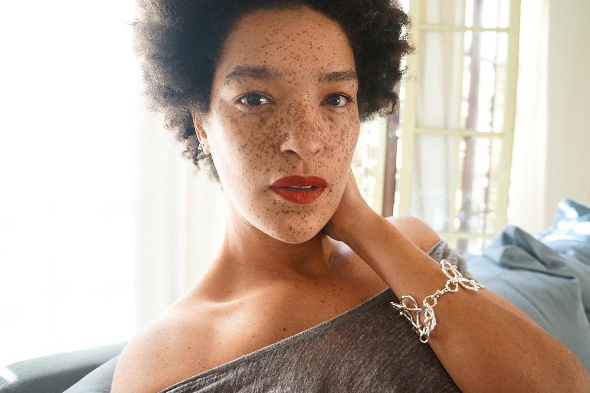 Nàng người mẫu nổi bật nhờ gương mặt tàn nhang