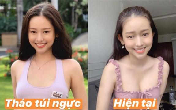 Thúy Vi xuất hiện với vòng 1 căng đầy vướng nghi vấn đặt lại túi ngực