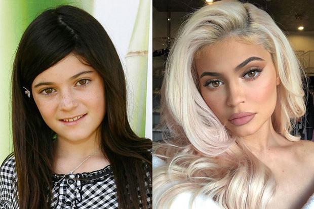 "Ngã ngửa" với loạt ảnh trước và sau "trùng tu" của Kim Kardashian và hàng loạt sao nữ