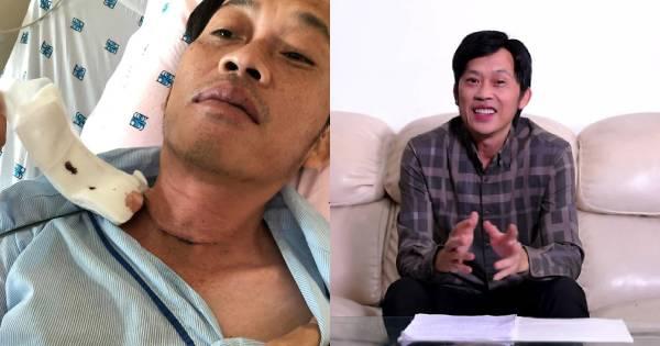 Hoài Linh tiết lộ bị u ác tuyến giáp, phải phẫu thuật cách đây 6 tháng