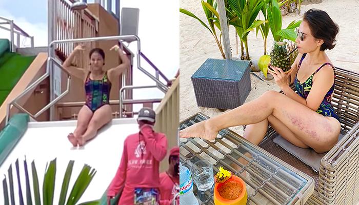 Thu Minh diện áo tắm, vô tình để lộ vết bầm bất thường dọc đùi