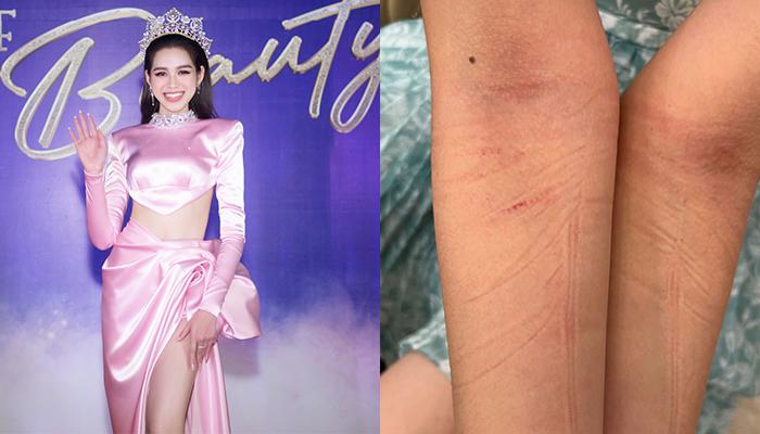 1 giờ đi sự kiện của Đỗ Thị Hà: Đằng sau hình ảnh hoàn hảo, nụ cười rạng rỡ là hai cánh tay rướm máu