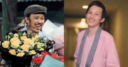 Hoài Linh bị phát hiện thay đổi 1 điểm phong thủy trên gương mặt trong ngày tái xuất