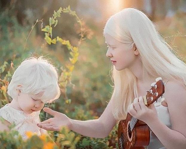 Ngỡ ngàng trước vẻ đẹp của cặp chị em gái bạch tạng