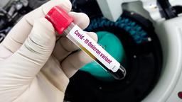 Omicron ảnh hưởng đến phổi thế nào so với các biến chủng khác