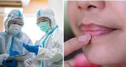 Dấu hiệu nhiễm Omicron đặc trưng trên da, môi và móng tay, nhận biết sớm sẽ tự cứu mình