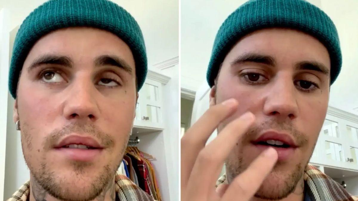 Justin Bieber hủy mọi show diễn vì bị liệt nửa mặt do nhiễm virus hiếm