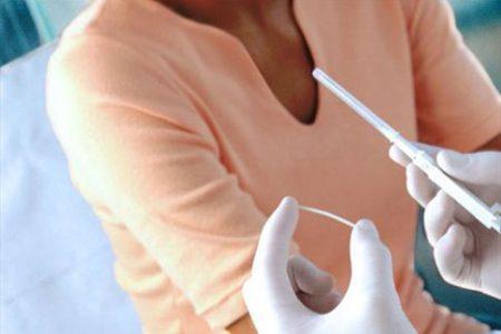 Những điều chị em cần biết khi cấy que tránh thai