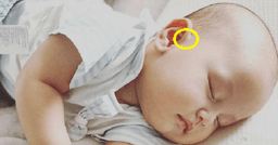 Rò luân nhĩ: Dị tật bẩm sinh mà hai con trai của Hồ Ngọc Hà mắc phải là bệnh gì?