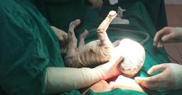 Yên Bái: Bé trai chào đời bị da vảy cá, bị vảy trắng bao phủ toàn thân với nhiều vết rạn chảy máu