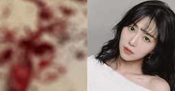 Nghi vấn Kwon Mina (cựu thành viên AOA) tự tử lần 3 khi đăng ảnh bàn tay đầy máu