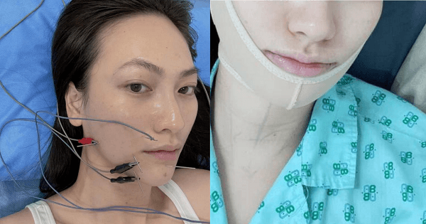 Nữ diễn viên Phương Anh Đào vừa phẫu thuật u tuyến giáp