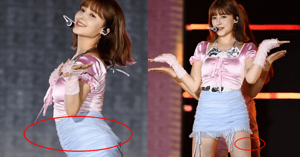 Nancy (MOMOLAND) lại trở về eo bánh mì, đôi chân bầm đen khó hiểu