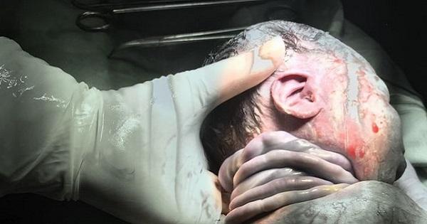 Hy hữu: Bé trai ở Hà Nội chào đời an toàn với 7 vòng dây rốn quấn chặt cổ