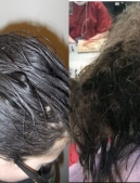 Sợ hói đầu, 1 cô gái nhịn gội trong 3 tháng, kết quả mất 11 triệu để gỡ rối