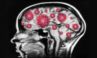 Covid-19 có thể xâm nhập vào não người