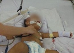 Bé trai 12 tuổi tử vong sau 7 ngày mắc bạch hầu