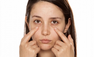 Trị thâm quầng mắt với bài tập yoga đơn giản tại nhà