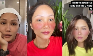 H'hen Niê đã làm gì với hai gò má của mình mà khiến fan 'hú hồn'?