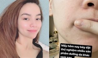 Hồ Ngọc Hà nhận 'cái kết đắng' chỉ vì một thói quen skincare mà nhiều cô nàng cũng thường mắc phải