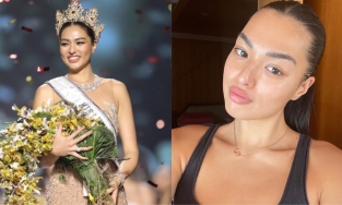 Từng ám ảnh vì mụn, Miss Universe Thái Lan tiết lộ 'vật bất ly thân' giúp cô lấy lại làn da mịn màng