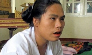 Người phụ nữ biến thành đàn ông sau khi ngủ dậy