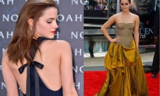 Emma Waston 'lồng lộn' đi thảm đỏ, không ngại khoe khuyết điểm to đùng trên cơ thể