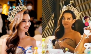 Netizen lắc đầu khó hiểu: Điều gì đang xảy ra với đôi môi sưng vù của Hoa hậu Thùy Tiên?