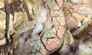 Đi ăn thấy miếng thịt ánh lên 7 sắc cầu vồng thì có ăn được không?