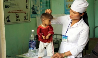 Hội chứng 'người lùn đầu chim' mà cậu bé K'Rể mắc phải và cách phòng tránh