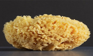 Cần Thơ: 10 viên sỏi to như san hô trong thận người đàn ông 60 tuổi