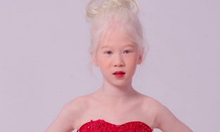 Chân dung người mẫu bạch tạng 8 tuổi trình diễn tại Tuần lễ thời trang Việt Nam 2020