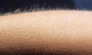 Tại sao chúng ta lại 'nổi da gà'?