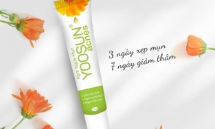 5 cách giảm mụn nội tiết an toàn, hiệu quả