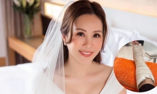 Hoa hậu Thu Hoài gặp chấn thương nghiêm trọng sau khi về chung nhà với tình trẻ kém 10 tuổi