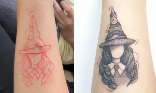 9X Hà Nội xoá bỏ mặc cảm sẹo lồi bằng việc xăm mình 