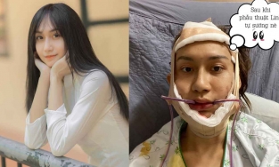 Hơn 1 tỷ đồng là số tiền Lynk Lee đã chi để trở thành mỹ nhân như hiện tại