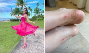 Đỗ Thị Hà mang giày cao gót phồng rộp cả chân là do cô chưa biết đến những mẹo này