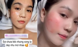Ngọc Trinh khoe mặt châm chích lấm chấm đỏ, còn quảng cáo 'đẹp như mơ': Chuyện gì đang xảy ra?