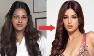 5 cách đánh bay quầng thâm mắt cấp tốc cho những cô nàng phải thường xuyên chạy 'deadline'