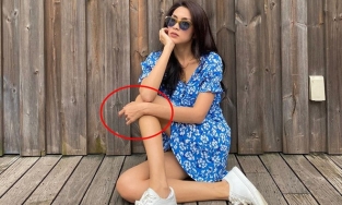 Hà Tăng gầy gò đáng báo động với đôi tay và chân nổi gân chằng chịt