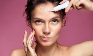 Hướng dẫn cách chăm sóc da sau trị mụn, giảm thâm mờ sẹo hiệu quả