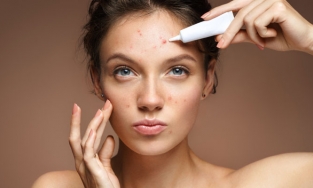 [Kinh nghiệm] Các bước chăm sóc da mụn tại nhà