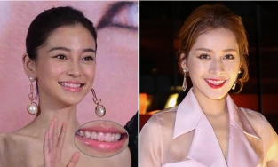 Lỗi trang điểm phổ biến tới nỗi từ Anglela Baby, Phạm Băng Băng đến Chi Pu ai ai cũng mắc